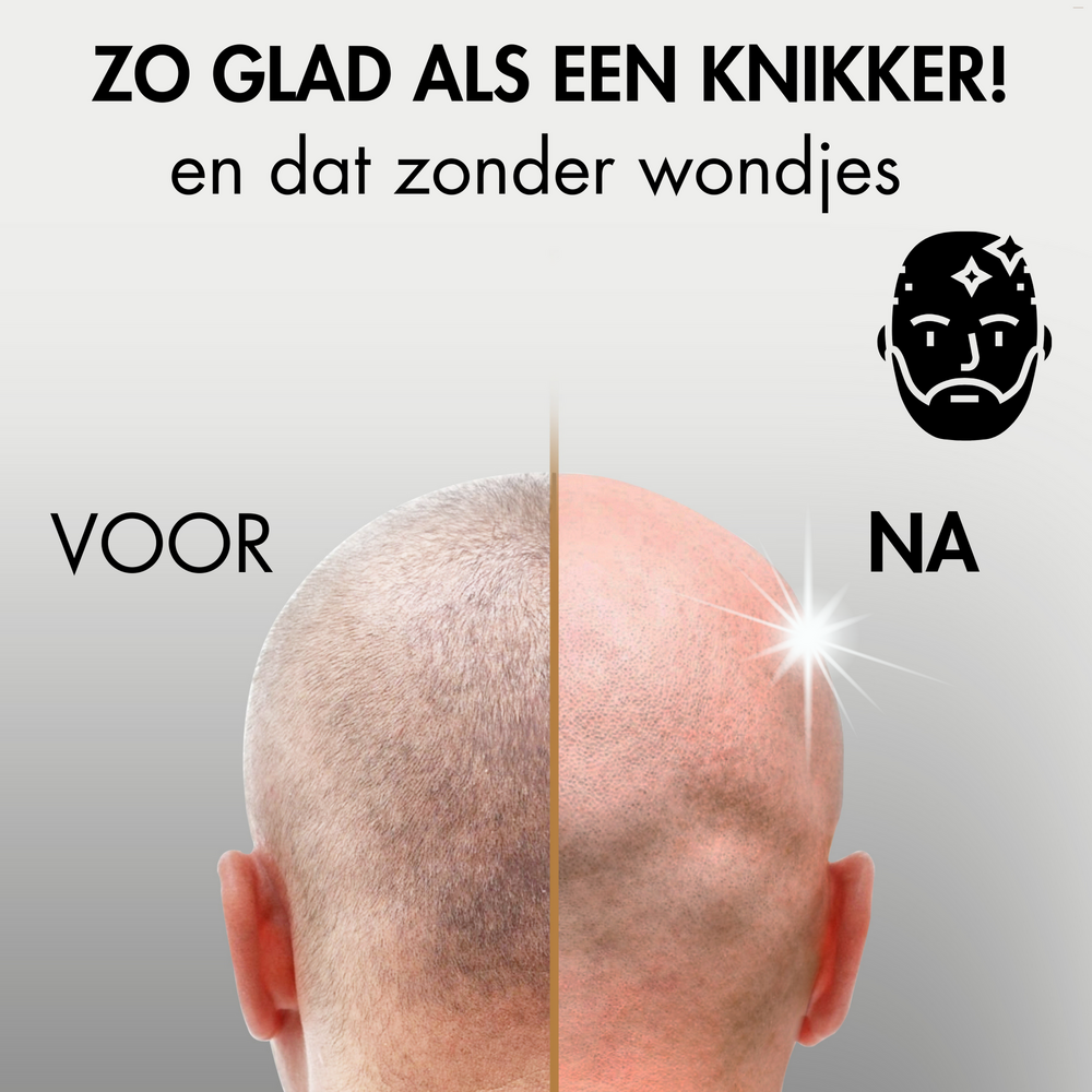 Sansbeaut&eacute;&reg; Hoofdscheerapparaat + Extra Scheerkop | Pro Magnetic