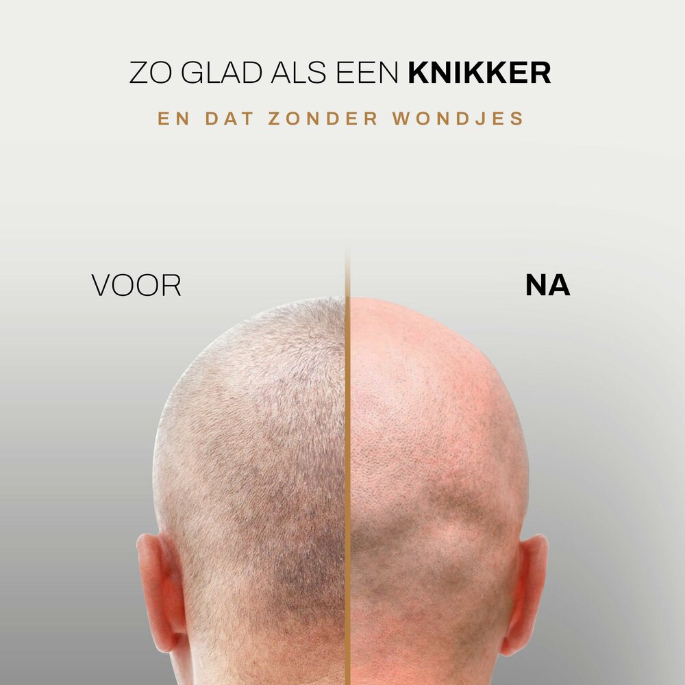 Sansbeaut&eacute;&reg; Hoofdscheerapparaat + Extra Scheerkop | Rpm Max