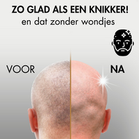 Sansbeaut&eacute;&reg; Hoofdscheerapparaat + Extra Scheerkop | Pro Magnetic