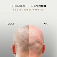 Sansbeaut&eacute;&reg; Hoofdscheerapparaat + Extra Scheerkop | Rpm Max
